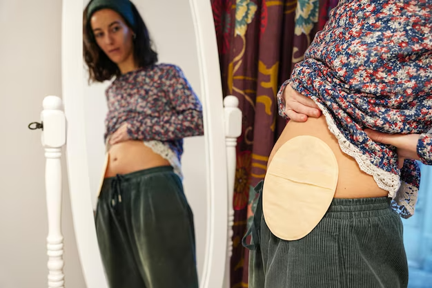 Itabirito institui campanha de conscientização para pessoas ostomizadas