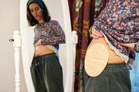 Itabirito institui campanha de conscientização para pessoas ostomizadas